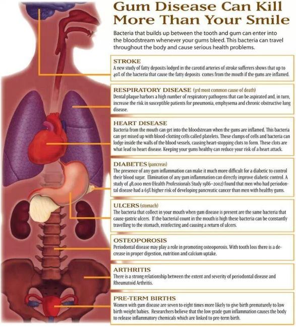 Marangaroo-Gum-Disease-Highclere-Dental-Centre