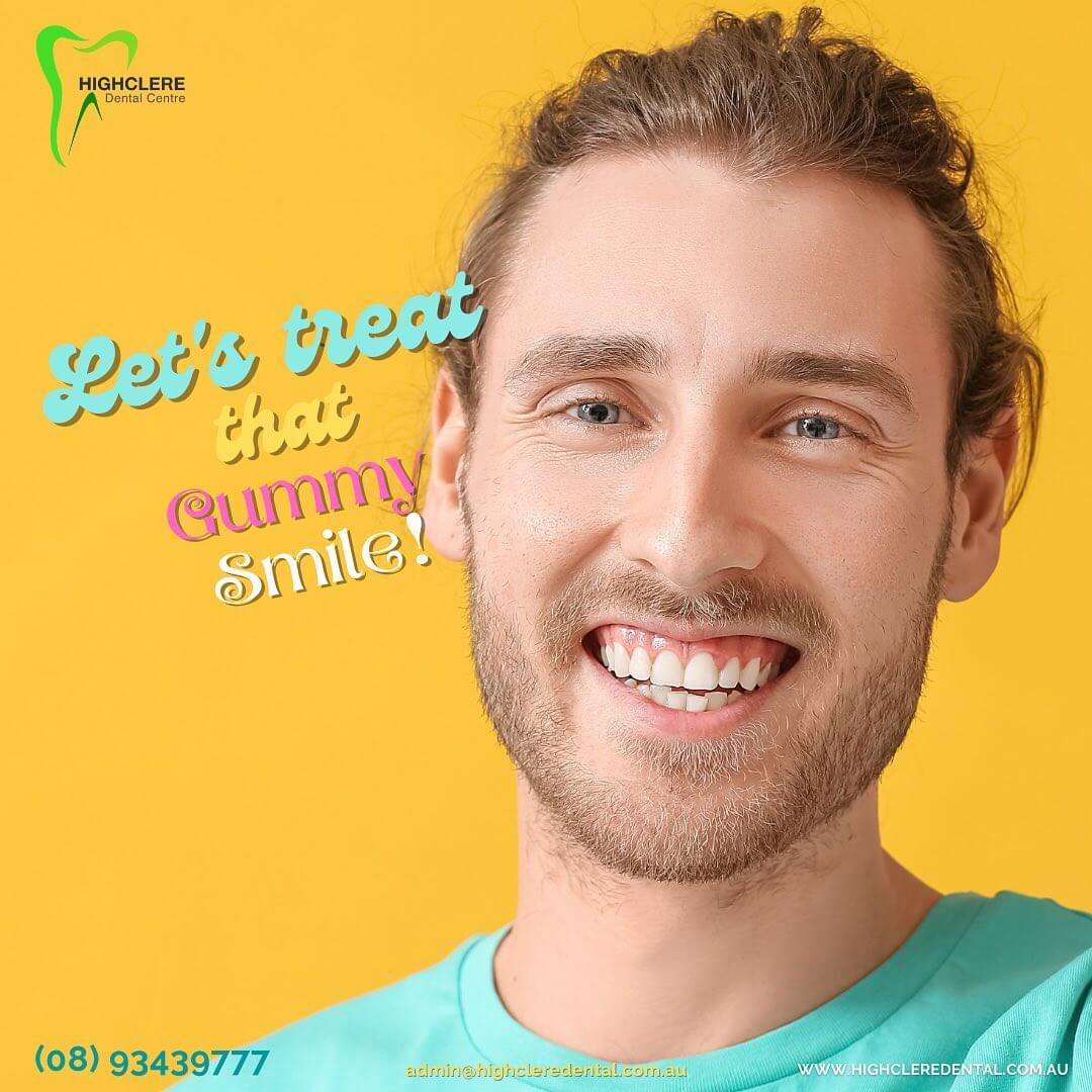 Marangaroo Dentist Highclere Dental Centre Smile Makeover